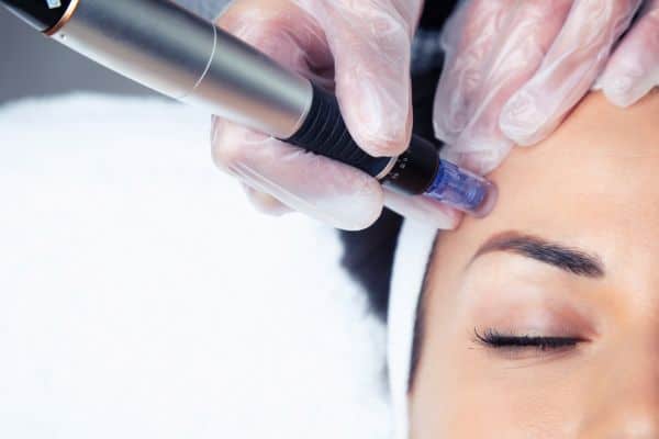 Explaining Total Skin Tightening Treatment and What to Expect 2 What Skin Concerns Can Total Skin Tightening Treatment Help With Higham Ferrers?