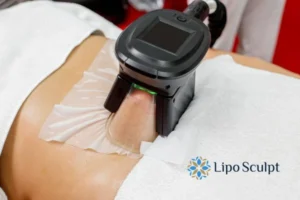 Does Fat Freezing At Home Work? 3 Fat freezing at home from Lipo Sculpt Higham Ferrers