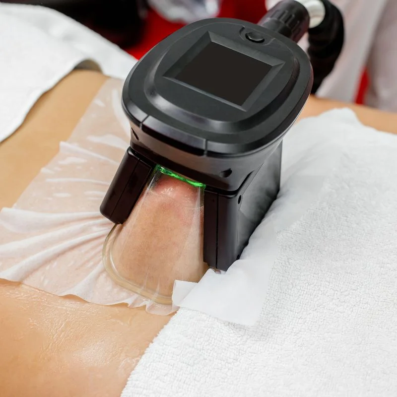 Fat Freezing treatment Higham Ferrers